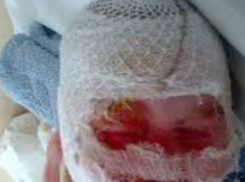 Недалеко от Шахт в поселке Казачьи Лагери маленькая девочка обварила себе лицо кипятком