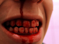 Житель Шахт пытался откусить тестю ухо и разбил лобовое стекло у скорой