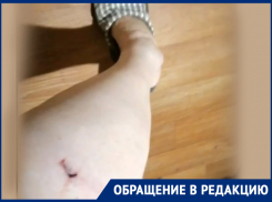 Стая угрожающе лаяла, укусил – вожак: еще один случай нападения бездомных собак 