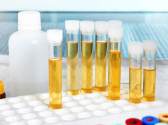 Сенсация! Ростовский ученый разработал методику выявления педофилов по анализу мочи