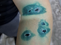 Бездомная собака напала на ребенка в детском саду в Шахтах