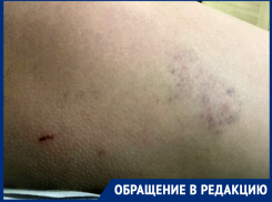 Просто шла и даже не обращала внимания: очередное нападение бездомной собаки в парке поселка Нежданная