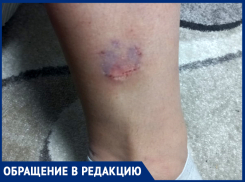 В январе собаки покусали 90 шахтинцев, и это только приехавшие в травмпункт 