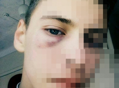 Двое взрослых мужчин напали и избили 16-летнего подроста, чтобы отобрать у него телефон в Шахтах
