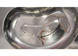 Ветеринары из Шахт прооперировали кошку, которая проглотила мишуру