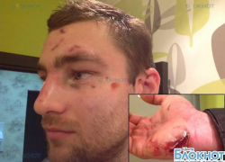 В Ростове неизвестные жестоко избили участника Олимпийских игр по гребле