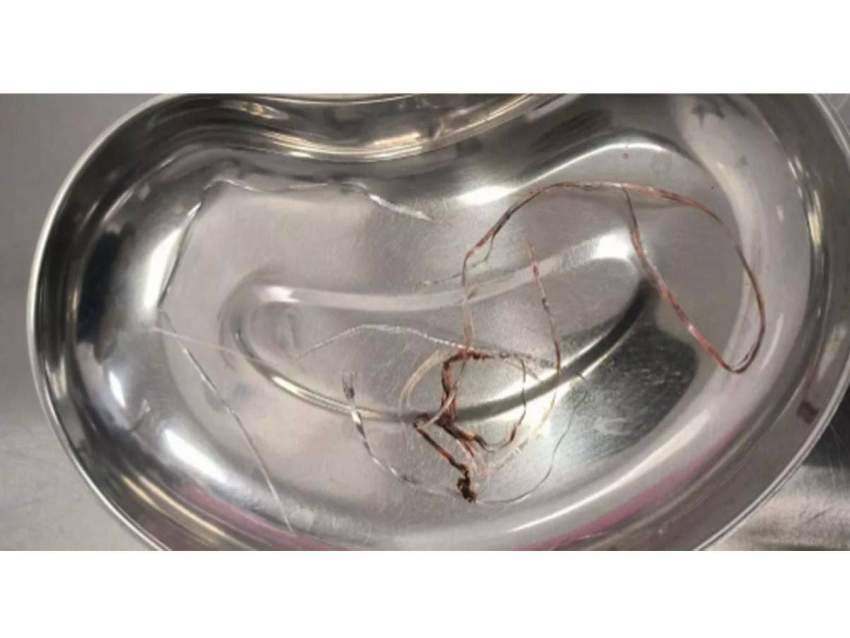 Ветеринары из Шахт прооперировали кошку, которая проглотила мишуру