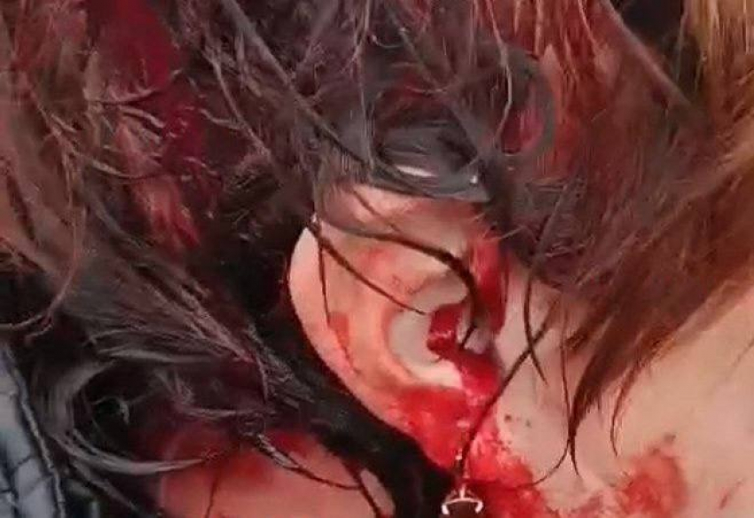 Неадекватный мужчина избил продавщиц на рынке в Шахтах